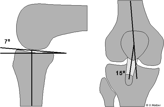 Component Alignment German