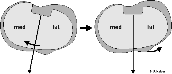 Component Alignment German