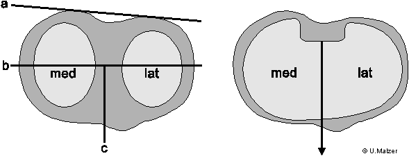 Component Alignment German